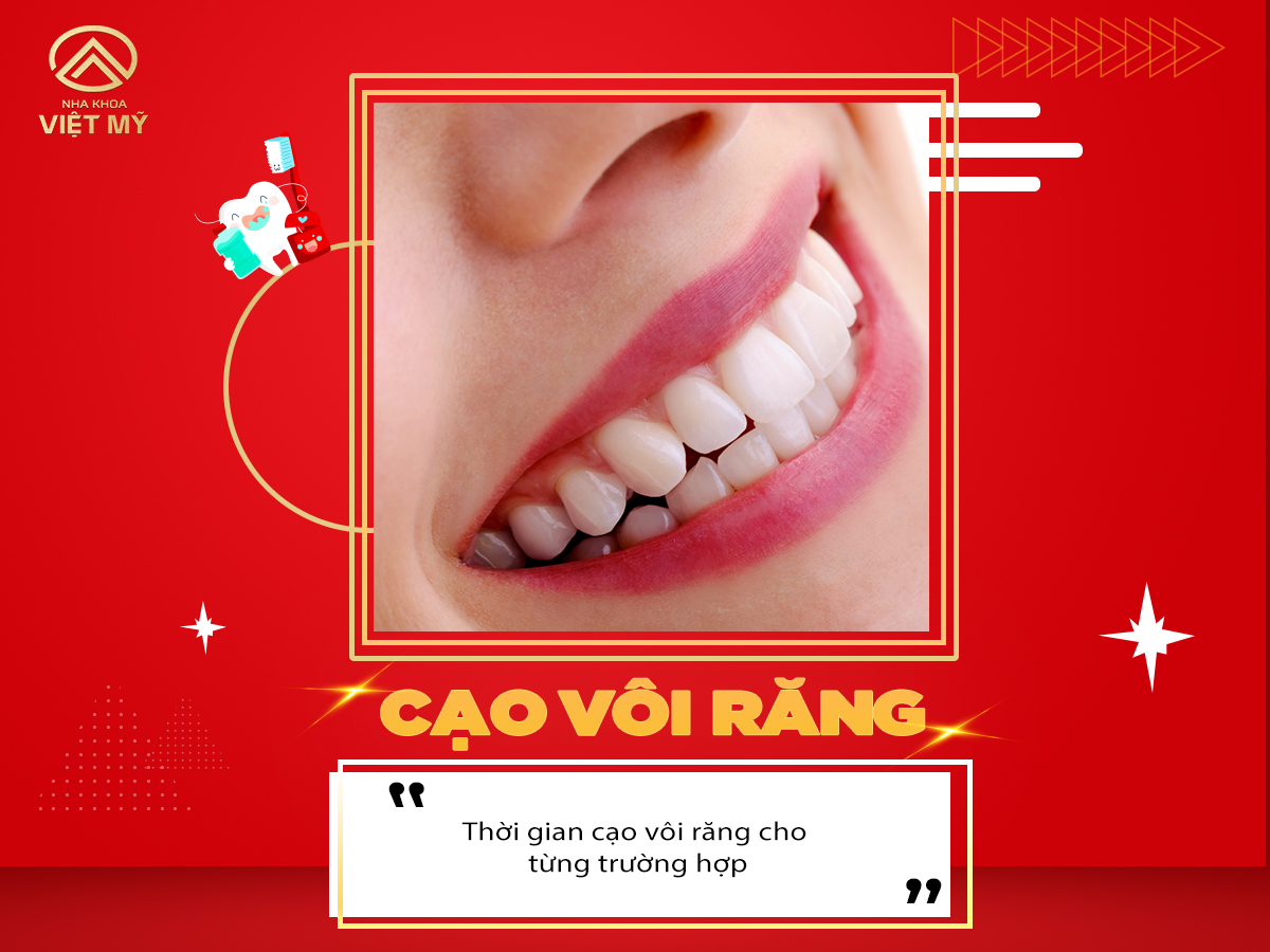 Bao lâu nên cạo vôi răng?