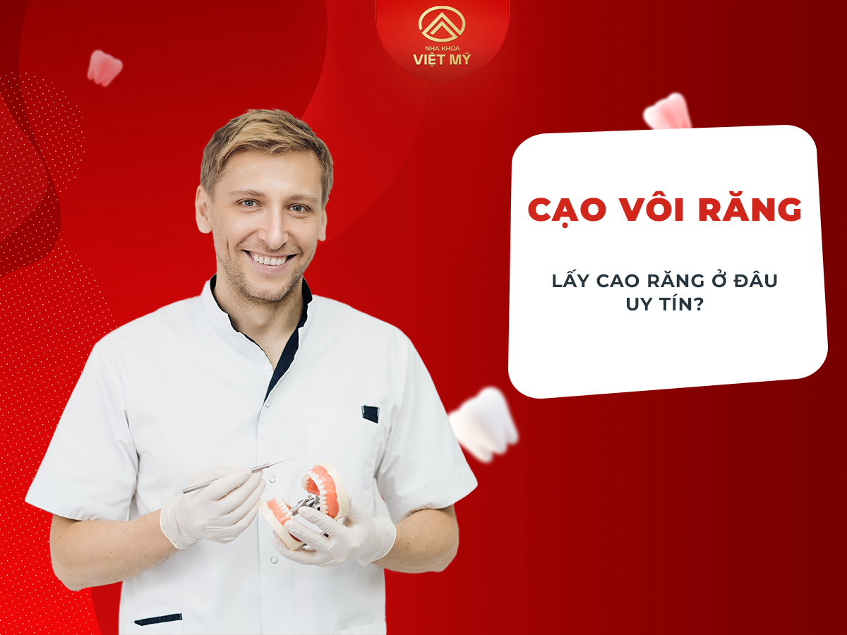 Bao lâu nên cạo vôi răng?