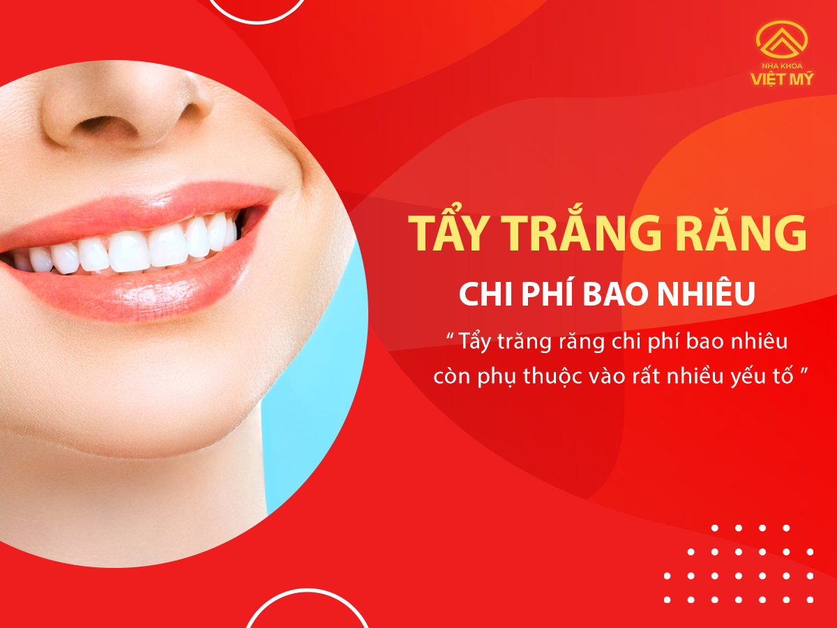 Chi phí tẩy trắng răng