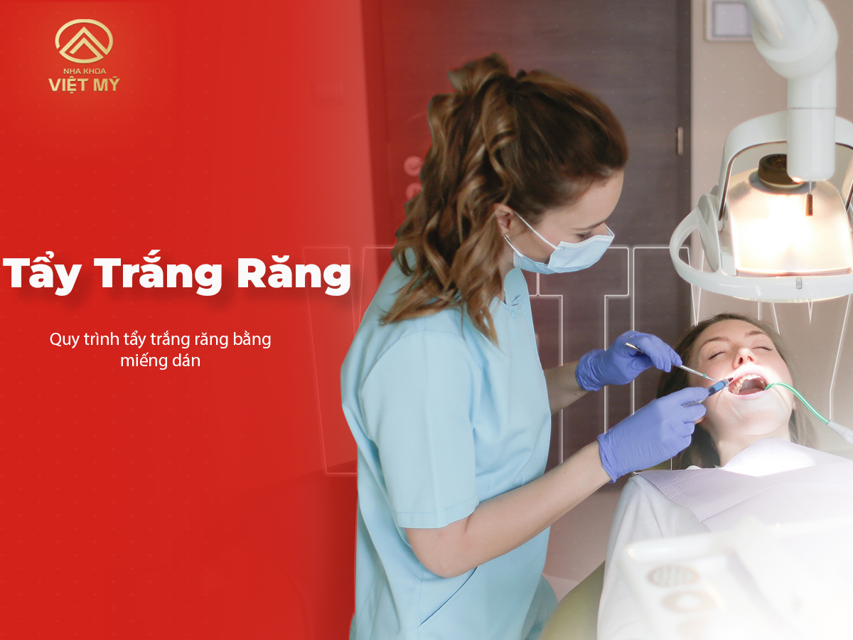 Quy trình tẩy trắng răng