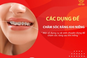 Cách chăm sóc răng miệng khi niềng răng