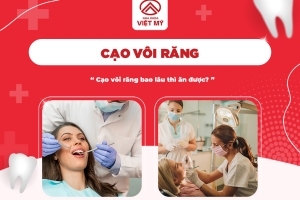 Cạo vôi răng bao lâu thì ăn được?