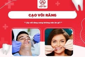 Cạo vôi răng xong nên ăn gì?