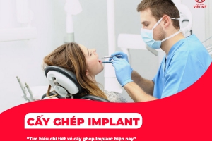 Cấy ghép implant là gì?