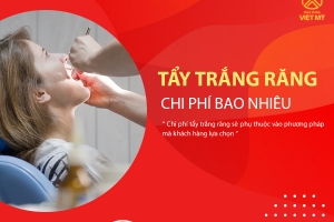 Chi phí tẩy trắng răng là bao nhiêu?