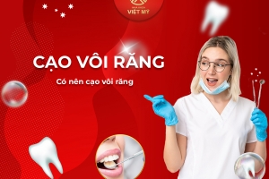 Có nên cạo vôi răng hay không?