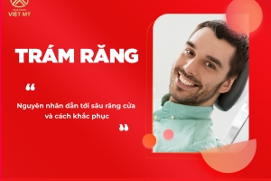 Có nên trám răng cửa bị sâu hay không?