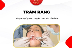 Giá trám răng lấy tuỷ hiện nay bao nhiêu?