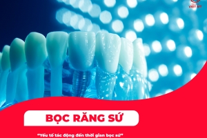 Giải đáp thắc mắc bọc răng sứ mất bao lâu?