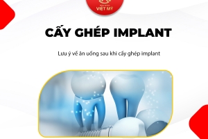 Một vài lưu ý sau khi cấy ghép implant