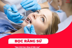 Quy trình bọc răng sứ được thực hiện ra sao?