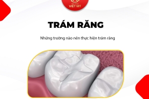 Quy trình trám răng được thực hiện ra sao?