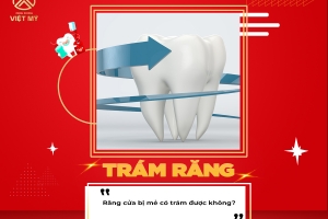 Răng bị mẻ có trám được không?