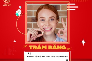 Trám răng có cần lấy tủy không?