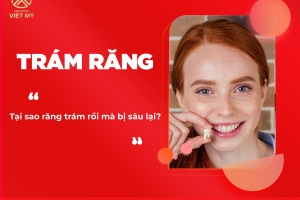 Trám răng rồi có bị sâu lại không?