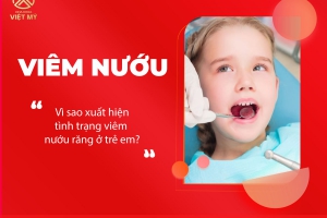 Viêm nướu răng ở trẻ em - Những điều bạn cần lưu ý 